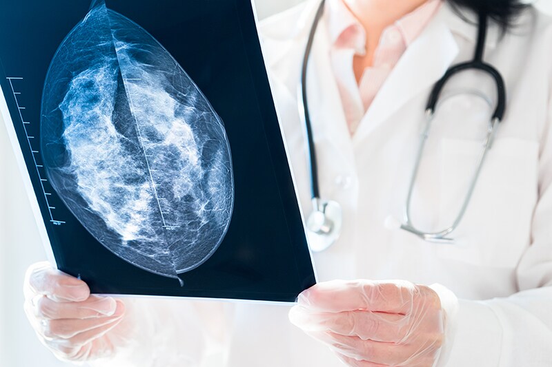 Making Sense of Mammograms