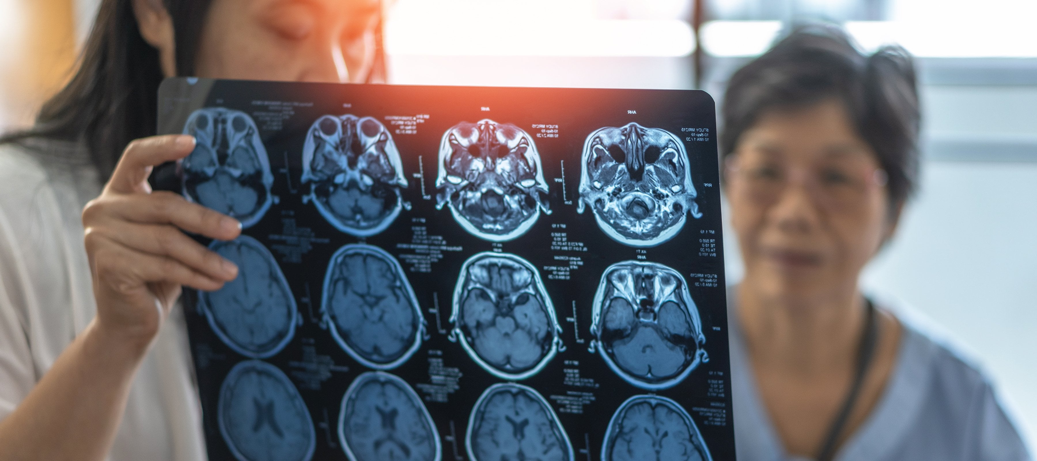 Doctor showing patient a brain scan.